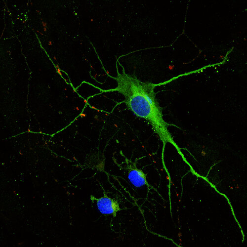 RCX mit LSD Dapi